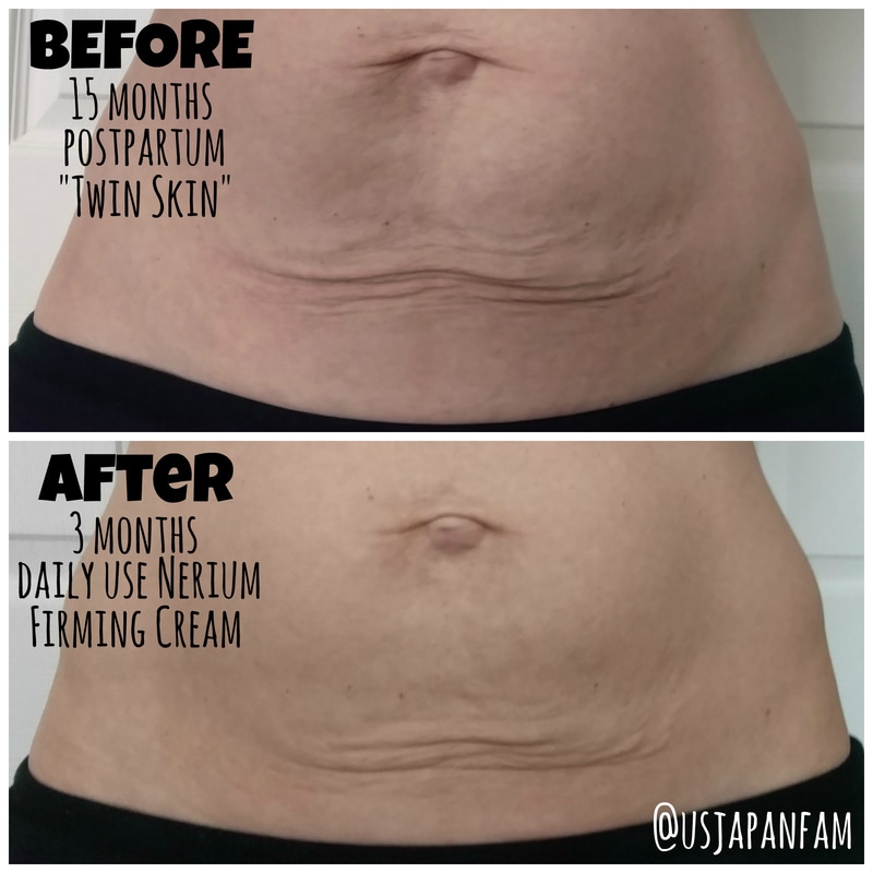 Usjapanfam Nerium Firming Cream Before And After 3months Orig 
